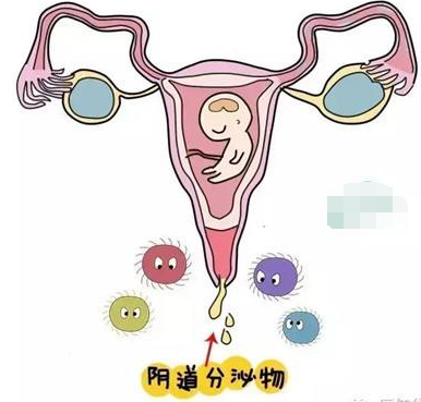 陰道分泌物黄瓜视频免费下载的一般性狀檢查類型