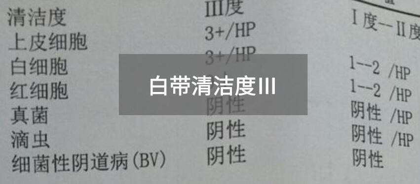 今天快訊！全自動白帶91黄瓜视频下载生產廠家黄瓜成视频人APP為您官方解釋白帶清潔度3的意思