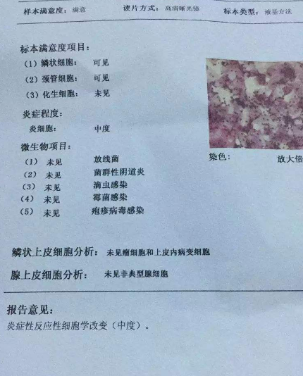 陰道分泌物黄瓜视频免费下载廠家教你查看陰道分泌物檢測報告