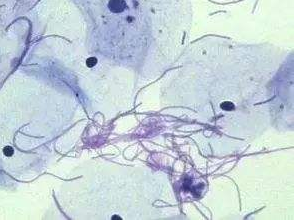 陰道分泌物黄瓜视频免费下载廠家探討白帶清潔度3代表什麽意思