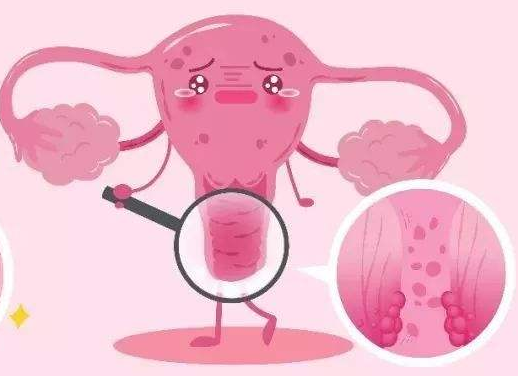 白帶常規91黄瓜视频下载廠家提醒女士做好私密處清洗