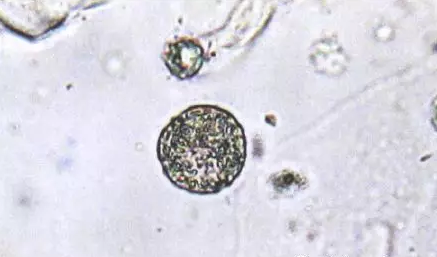 全自動陰道分泌物黄瓜视频免费下载剖析陰道分泌物的潔淨度規範