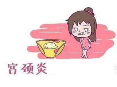 婦科白帶黄瓜视频免费下载廠家分析宮頸炎的症狀