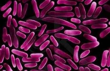 全自動白帶91黄瓜视频下载針對白帶常規檢查球菌和杆菌