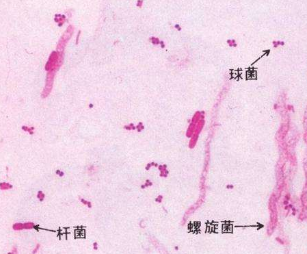 婦科白帶黄瓜视频免费下载廠家分析白帶線索細胞陽性的意義