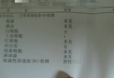 全自動白帶91黄瓜视频下载分享如何看懂白帶常規檢測報告單