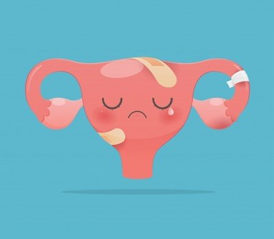 全自動陰道分泌物黄瓜视频免费下载提醒女士為什麽出現月經量減少的情況？