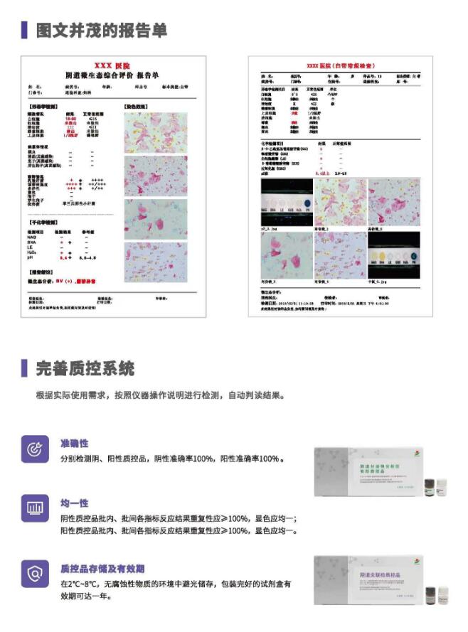 陰道分泌物91黄瓜视频下载V800報告單