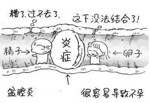 全自動婦科陰道分泌物91黄瓜视频下载檢測辨別婦科炎症複雜多樣！